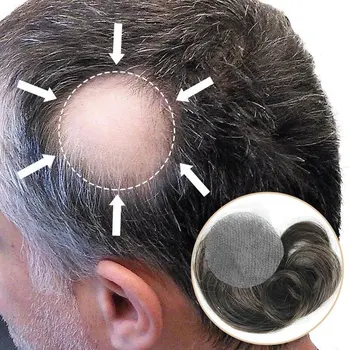 דק עור PU קרחת השיער תיקונים פאת שיער עבור גברים 8CM X 8CM V-כרך חתיכת שיער דבק על השיער החלפת מערכת הקרחת